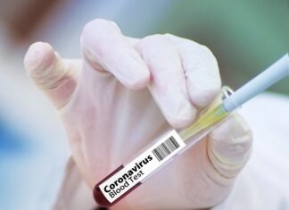 Coronavirus, in Toscana 84 nuovi casi e nessun decesso. 22 i guariti