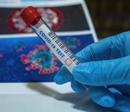 Coronavirus in Toscana: 110 nuovi casi, 1 decesso, 43 guarigioni