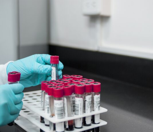 Coronavirus: in Toscana 88 nuovi casi, 2 decessi, 24 guarigioni