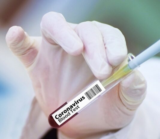 Coronavirus: 159 nuovi casi nell’aretino, 117 in degenza covid, 31 in terapia intensiva, 163 persone guarite, 2 decessi