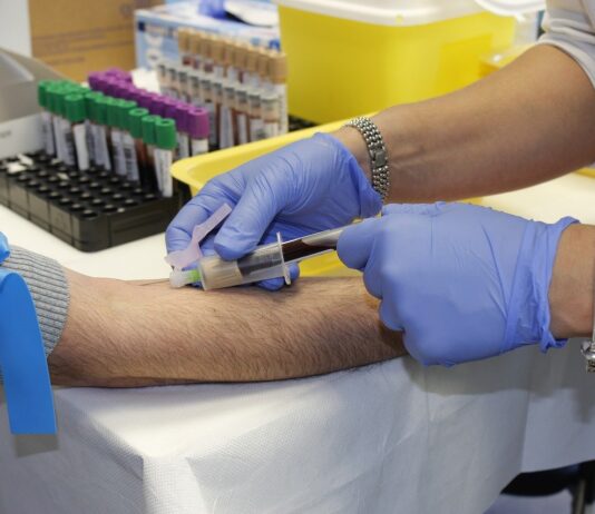Analisi del sangue al San Donato: da lunedì solo su prenotazione