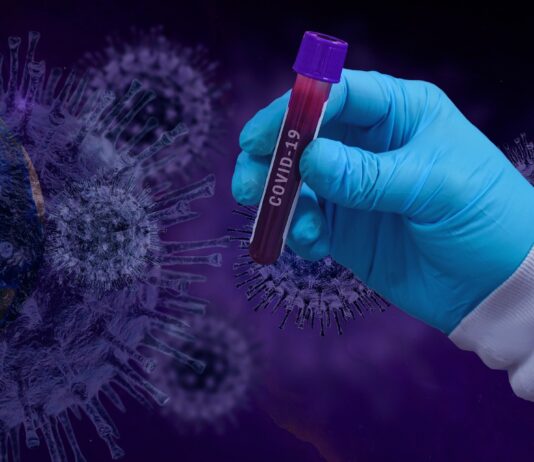 Coronavirus: 75 nuovi casi nell’aretino, 79 in degenza covid, 16 in terapia intensiva, 2 decesso