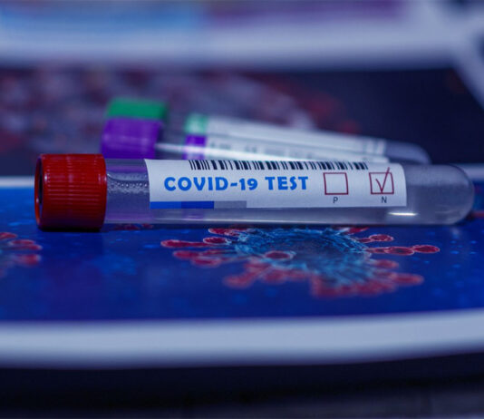 Coronavirus: 58 nuovi casi nell’aretino, 10 persone in degenza covid, 2 in terapia intensiva