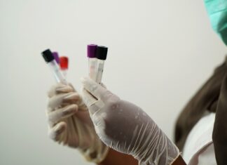 Coronavirus: in Toscana 559 nuovi casi. Sette i decessi con un’età media di 82 anni