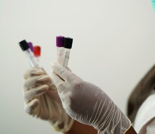 Coronavirus: in Toscana 559 nuovi casi. Sette i decessi con un’età media di 82 anni