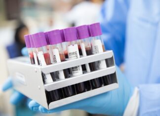 Coronavirus Toscana 541 i nuovi casi. Un decesso di 92 anni