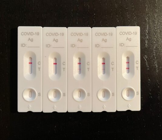 Coronavirus: in Toscana 238 nuovi casi e 6 decessi, di 77,7 anni d’età media